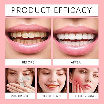 Probiotic Brightening White Toothpaste | SP10 by Oral Hoe