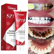 Probiotic Brightening White Toothpaste | SP10 by Oral Hoe